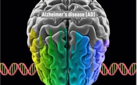 Công bố dữ liệu đầy đủ về thuốc lecanemab điều trị Alzheimer