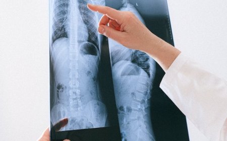 Ung thư phổi: Nguyên nhân, triệu chứng và điều trị