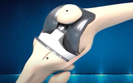 Lắp giả bộ phận toàn phần gối